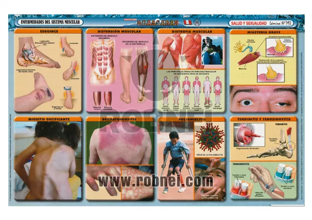 Enfermedades Sistema Muscular